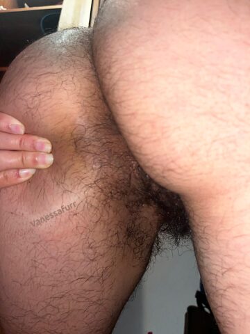 Мой парень бросил меня из-за волосатой задницы. Ты бы меня любил?